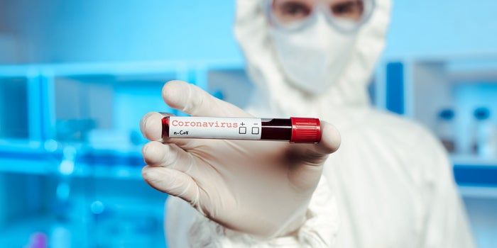 Reportan nuevo caso de Coronavirus en San Juan