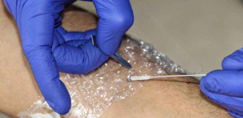 Recomienda Secretaría de Salud Jalisco medidas de prevención y autocuidado ante Mpox